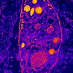 Say hello to my little friend... Toxoplasmosis Gondii