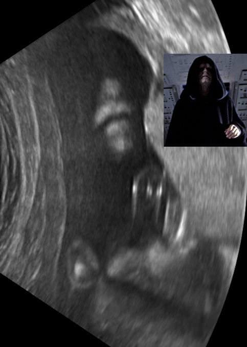 Emperor Palpatine Ultrasound Image